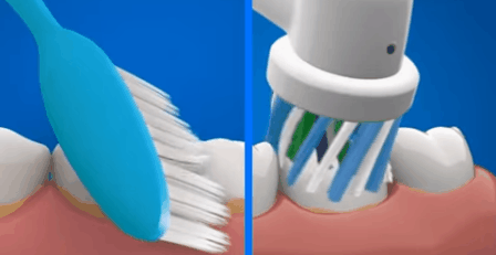 Электрические зубные щетки чистят зубы лучше, нежели обычные мануальные