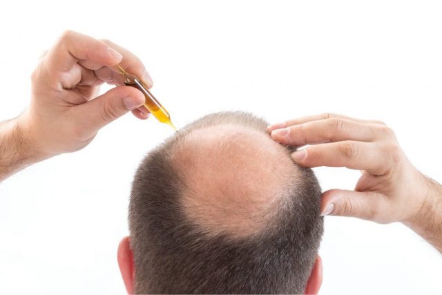 Средство для роста волос на голове у мужчин в аптеке